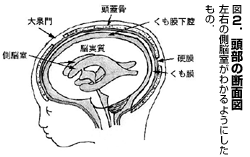 図2．頭部の断面図／左右の側脳室がわかるようにしたもの．